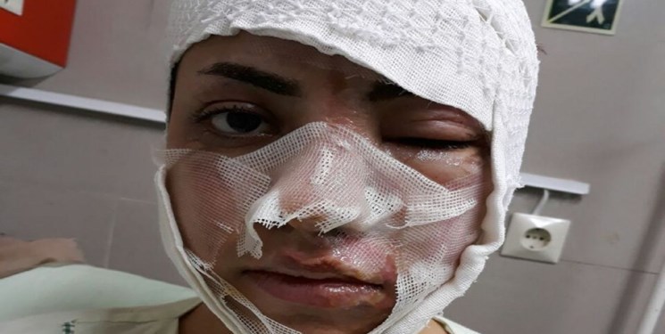 «نرگس» و «شیما» در آتش سوختند+عکس «نرگس» و «شیما» در آتش سوختند+عکس