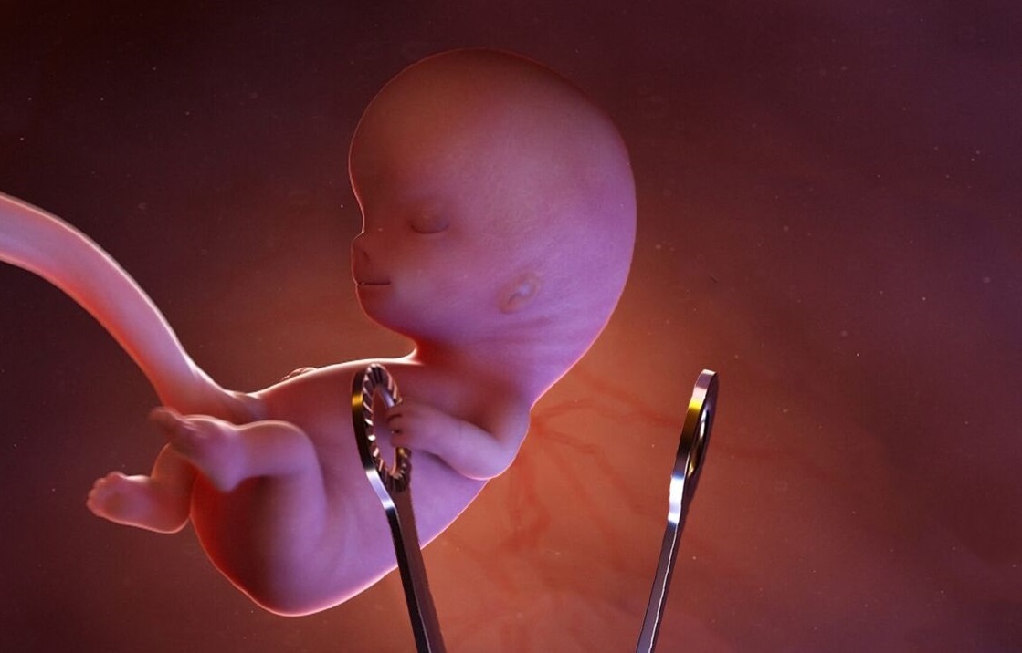 راه اندازی دومین مرکز مردمی «نفس» برای جلوگیری از سقط جنین در البرز راه اندازی دومین مرکز مردمی «نفس» برای جلوگیری از سقط جنین در البرز